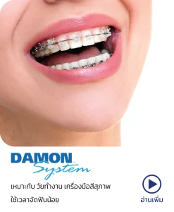 จัดฟันดามอน