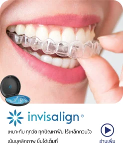 จัดฟันใส Invisalign