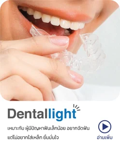 จัดฟันใส Dentallight