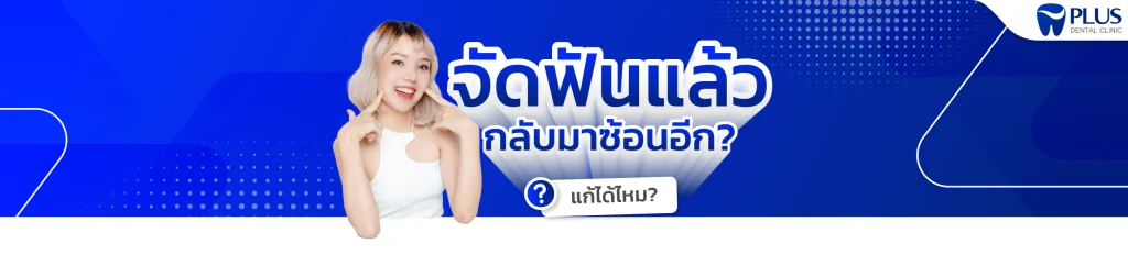 จัดฟัน