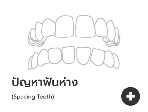 ฟันห่าง