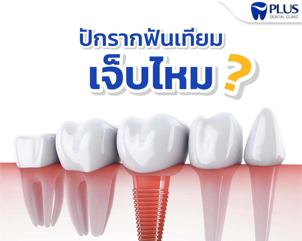 รากฟันเทียมเจ็บไหม