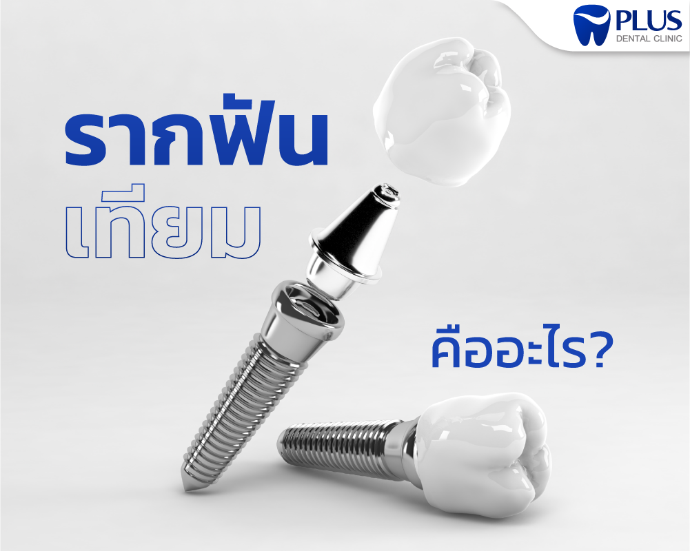 รากเทียม