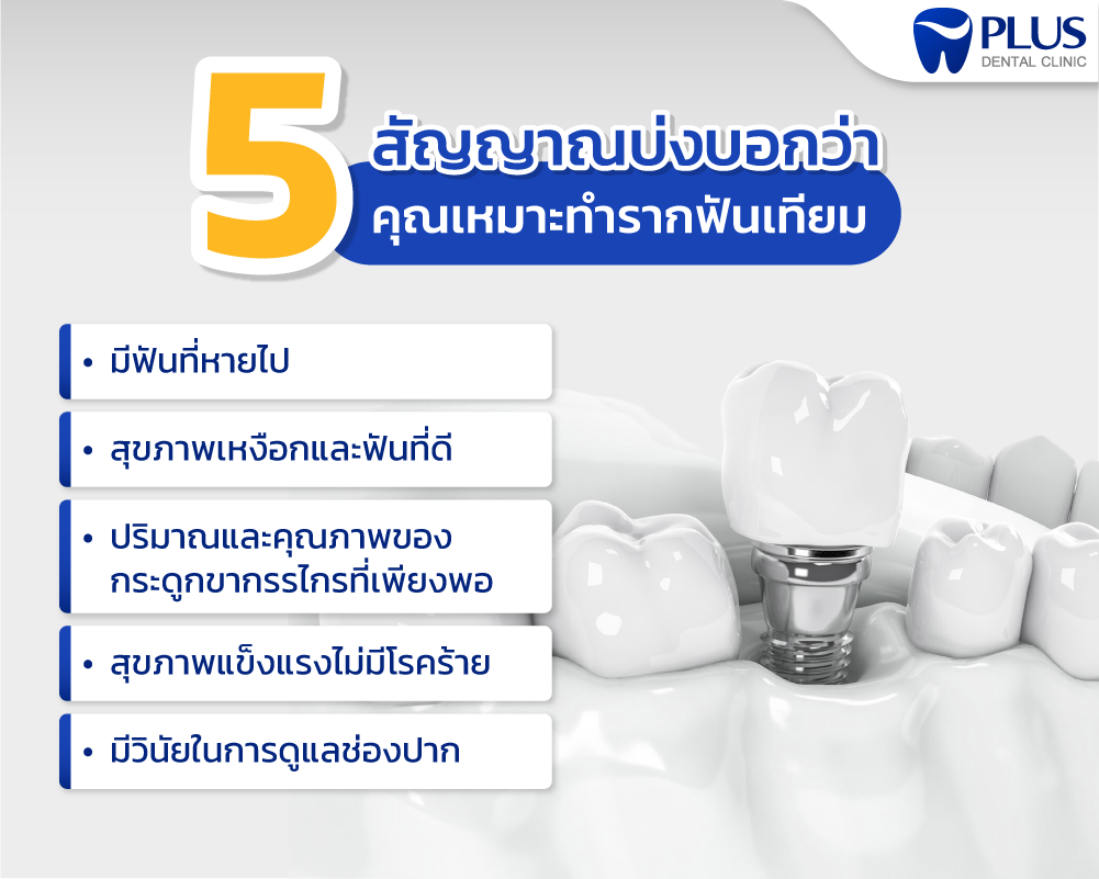 รากฟันเทียม