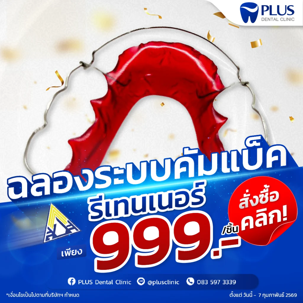 รีเทนเนอร์จัดฟัน