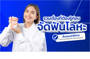 จัดฟันโลหะ