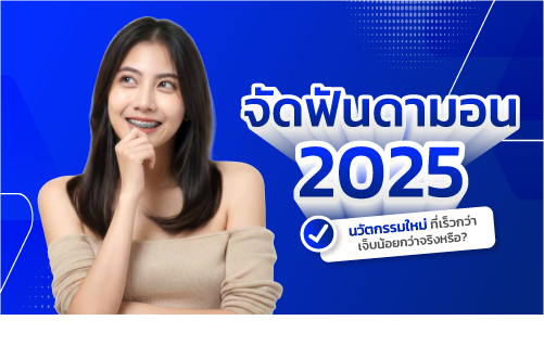 จัดฟัน