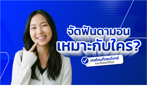 จัดฟัน