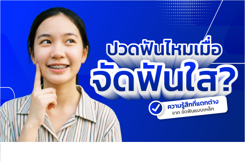 จัดฟัน