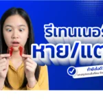 รีเทนเนอร์หลังจัดฟัน