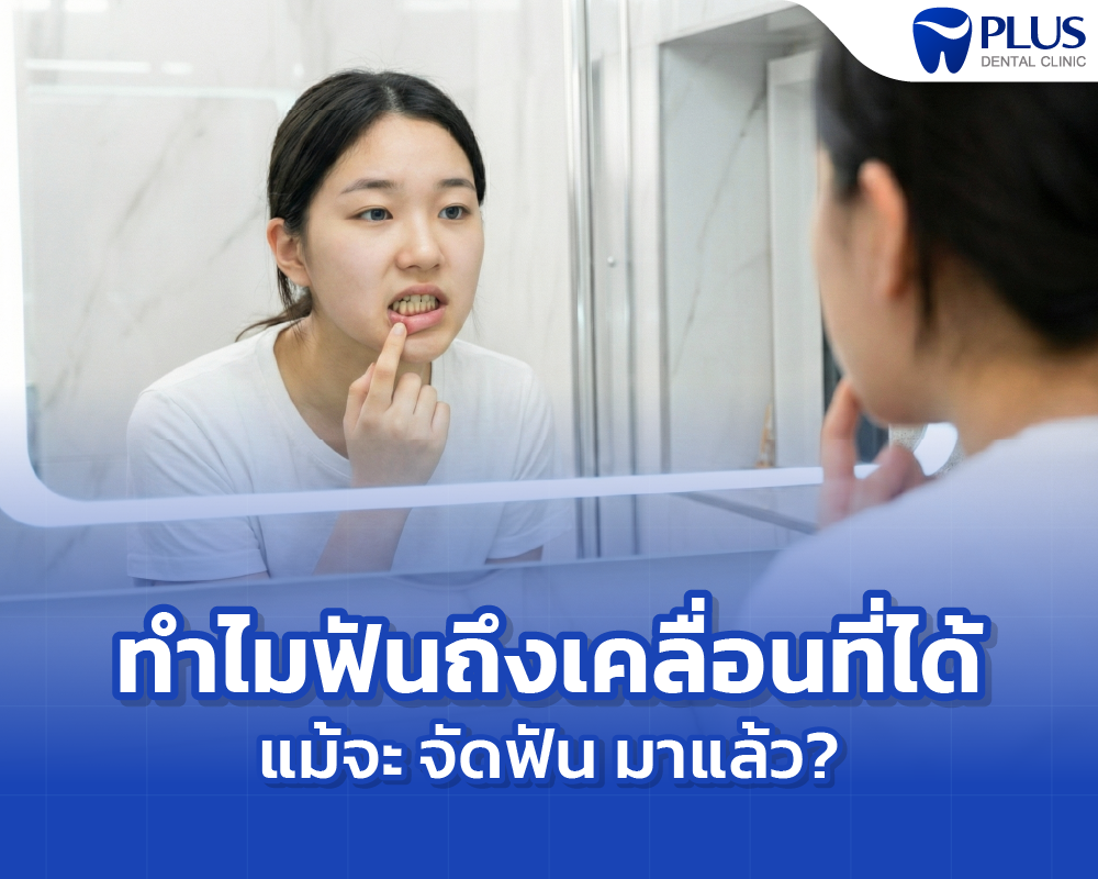รีเทนเนอร์หลังจัดฟัน