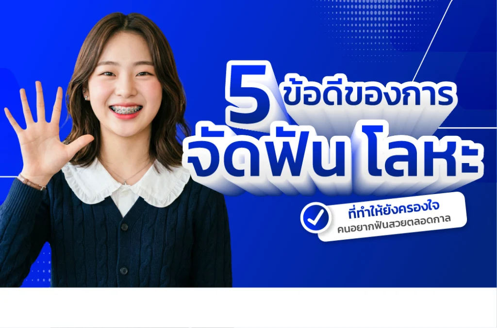 จัดฟัน