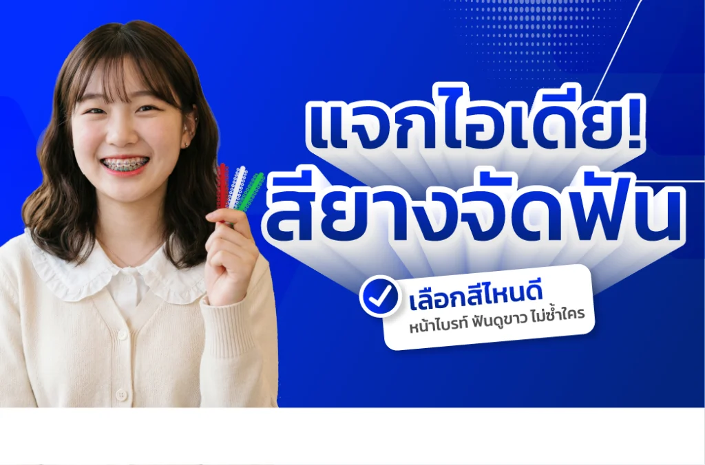 จัดฟัน