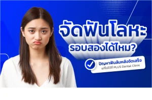 จัดฟัน